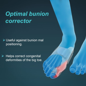 Bunion Splint